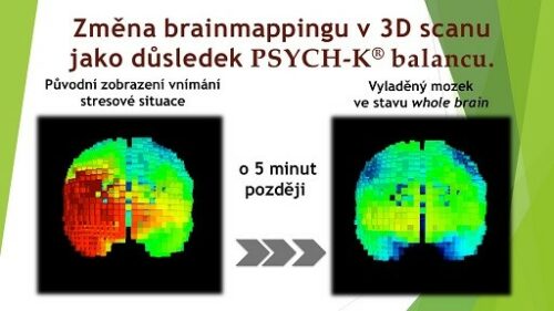 Brainmapping